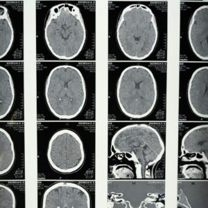 Advanced Diagnostics at Your Fingertips